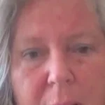 Dr. Nicoletta Casale, Chirurgin